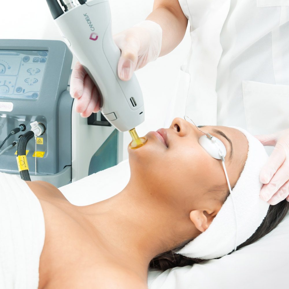 Laser Hair Removal Burlington | Body Hair Removal Cambridge MA Laser Hair Removal Burlington | Body Hair Removal Cambridge MA